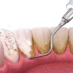 IMG_20251027_21110427images (5)